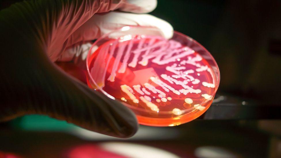 Mão com luva segurando uma placa com bactérias cultivadas em laboratório