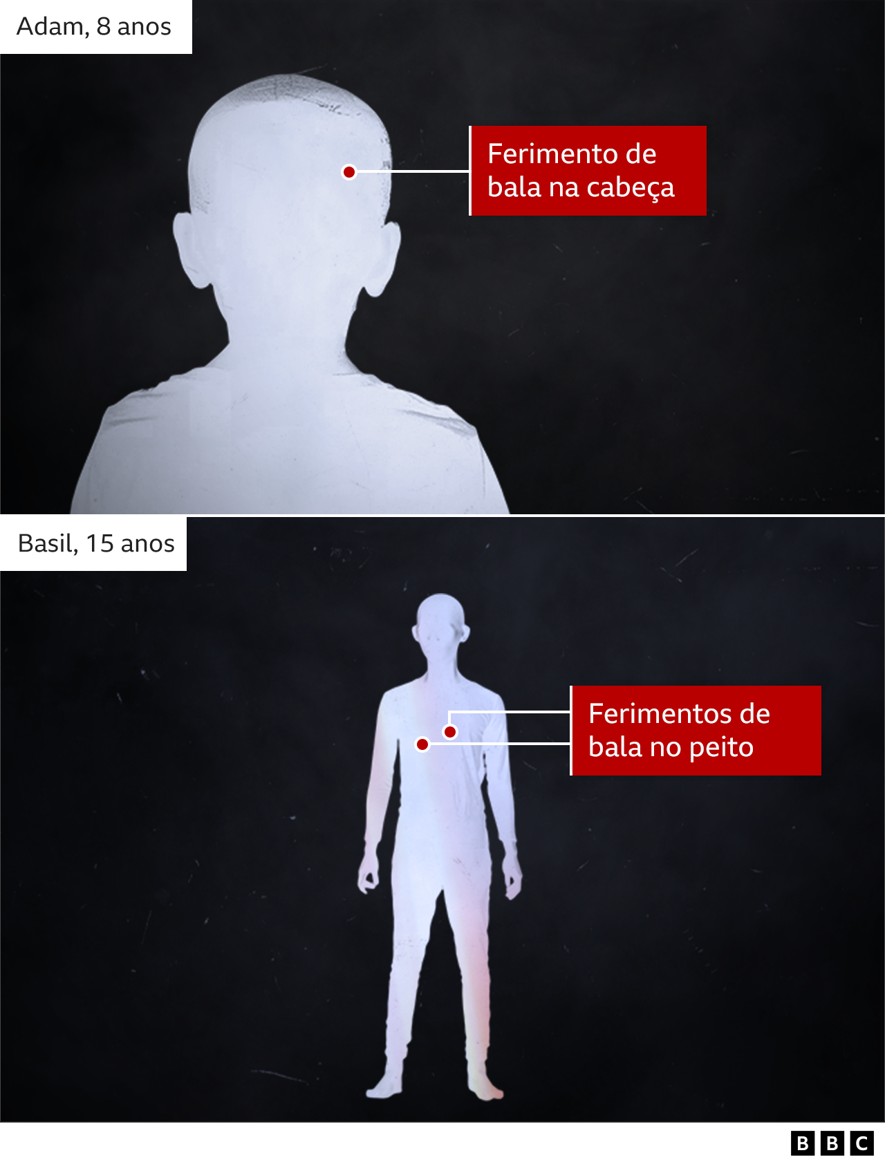 Infográfico mostrando o local do ferimentos a bala em Basil e Adam