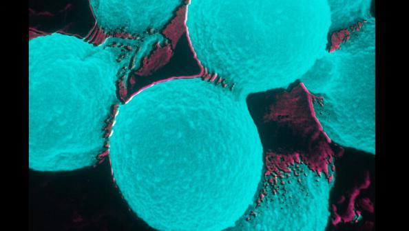 O fungo Cryptococcus
