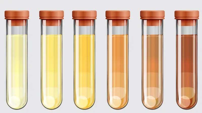 Ilustrasi warna urine.