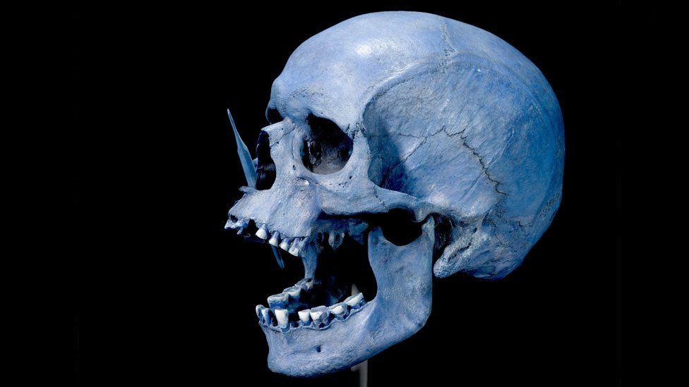 Crânio de homem neolítico encontrado em Porsmose, Dinamarca, em 1947