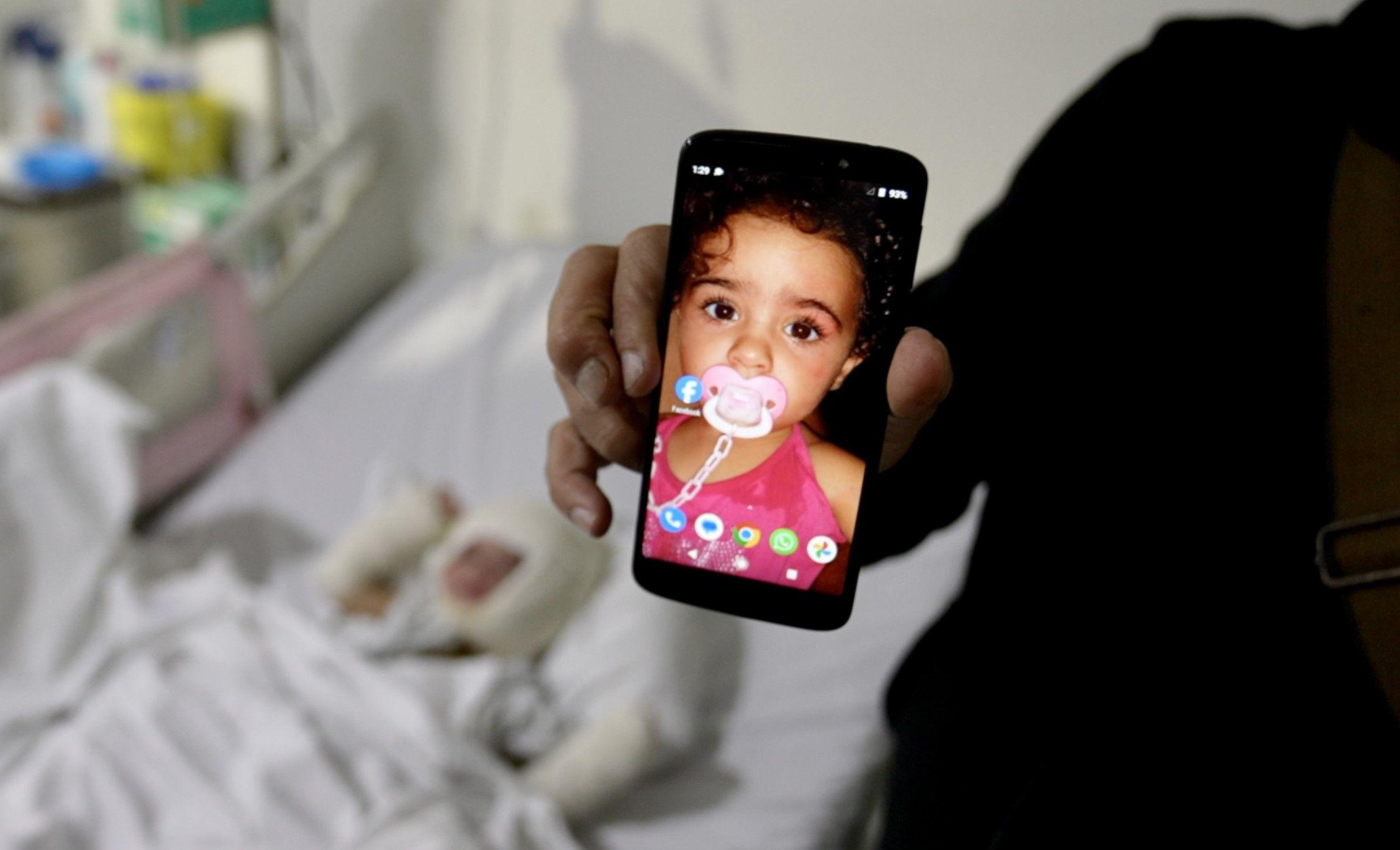 Lebanese father describes moment Israeli missile left toddler with third-degree burns