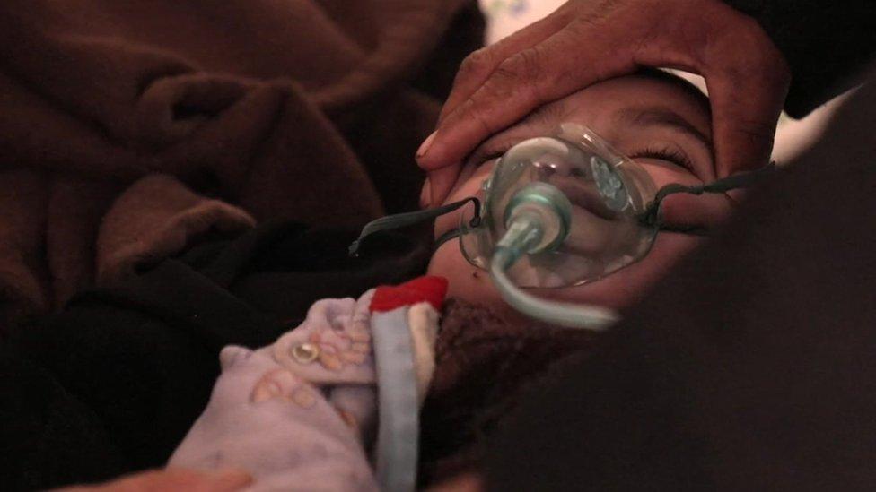 Anak kecil dengan masker oksigen di wajahnya