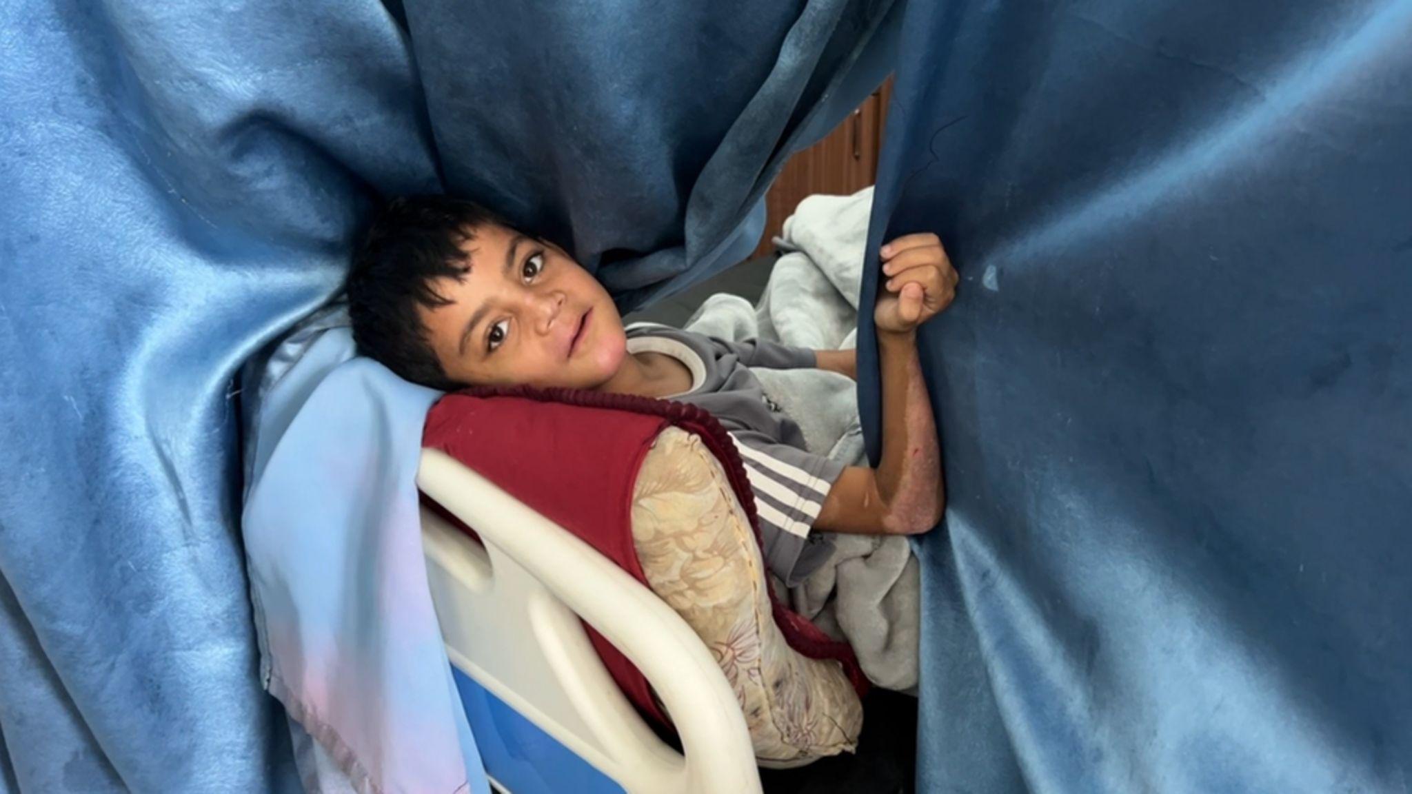 Un niño en una cama de hospital.