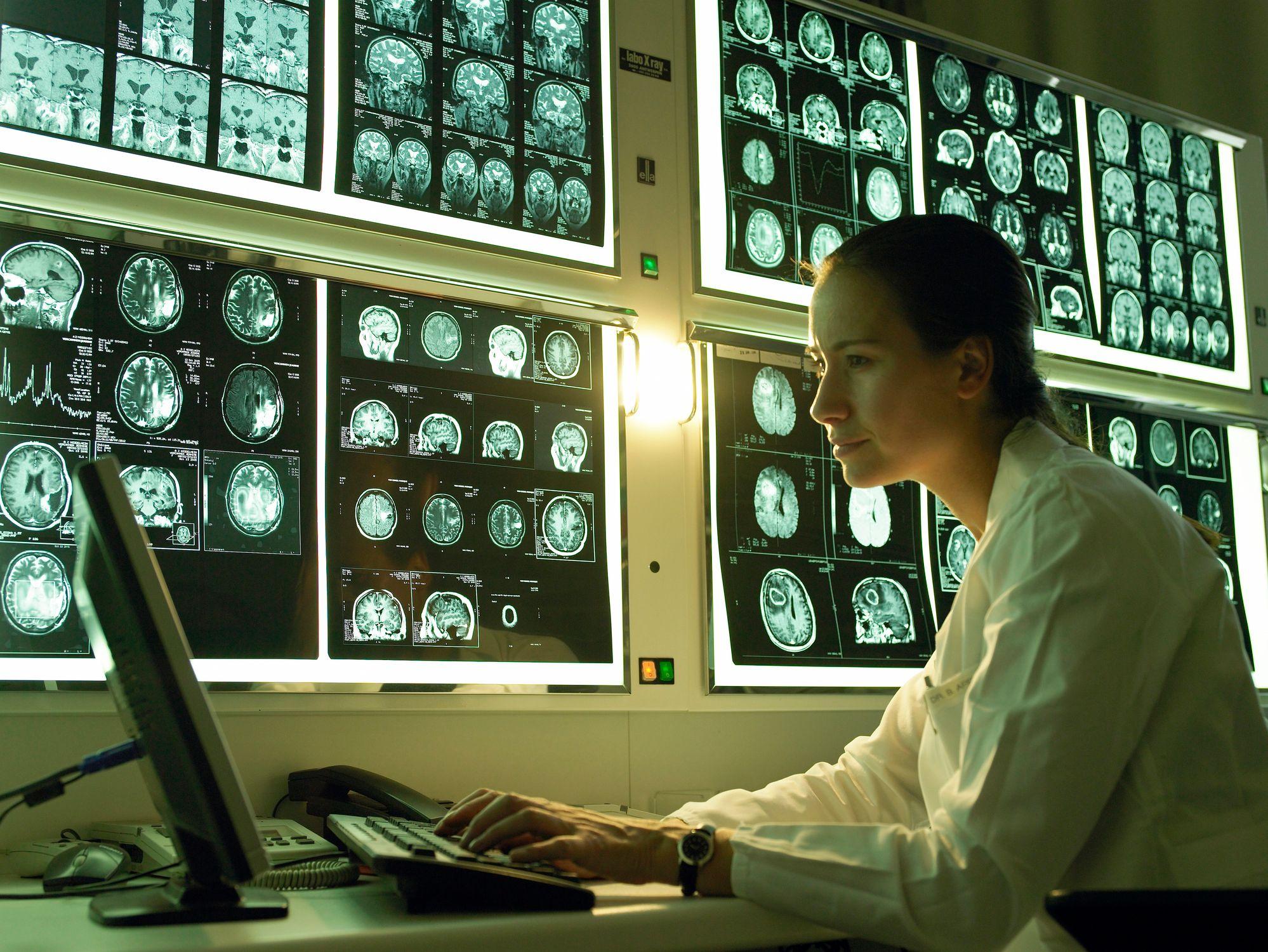 Una científica rodeada de radiografías de cerebros