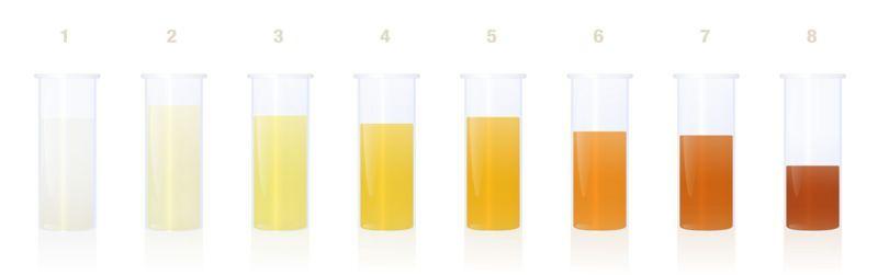 Diferentes colorações de urina