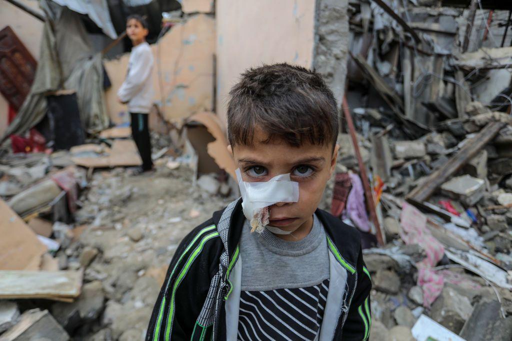 n injured Palestinian child is seen in front of a destroyed building, belonging to Abu Jazar family, following the Israeli attacks in Rafah, Gaza on November 15, 2023.