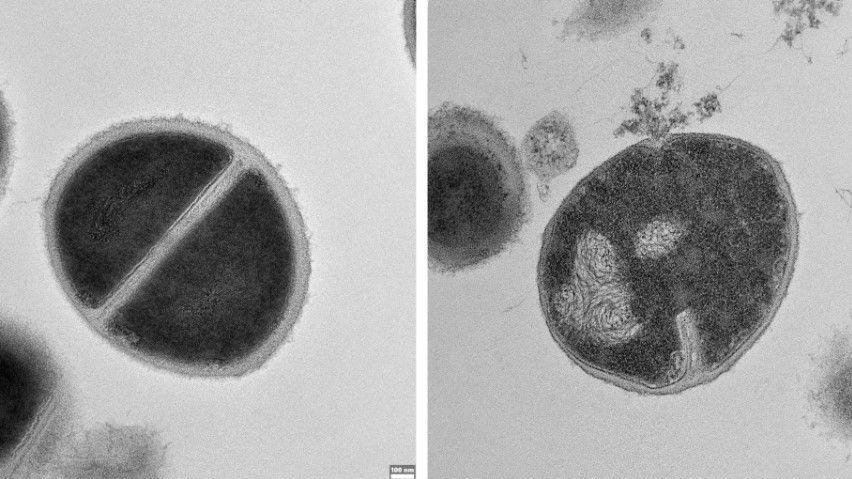 Bacterias Staphylococcus, una sana a la izquierda y otra siendo destruida cuando su capa externa se abre por acción de los antimicrobianos producidos por el proteasoma.