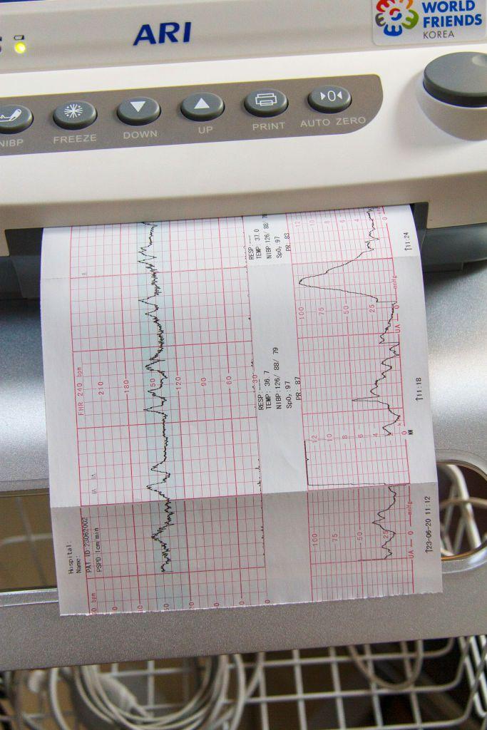 Electrocardiograma.