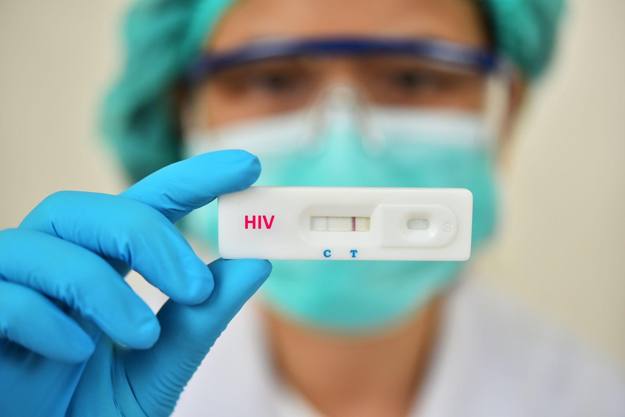 Ilustrasi tes HIV.
