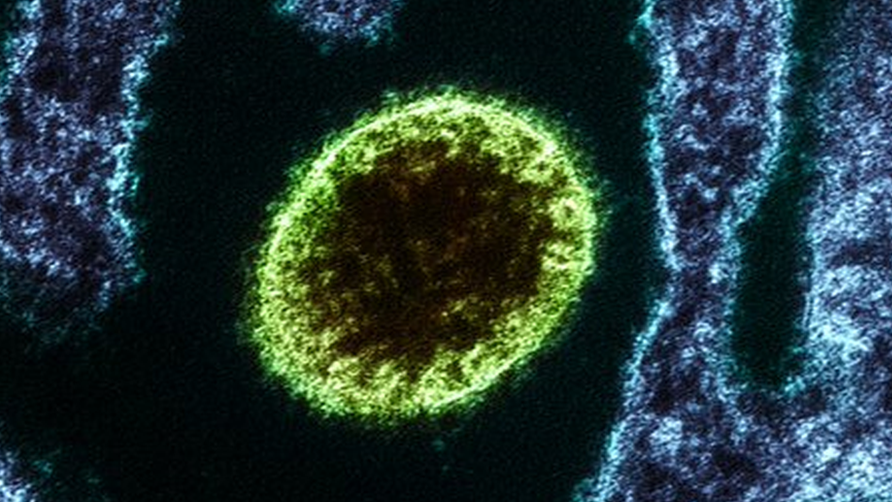 nipah virus