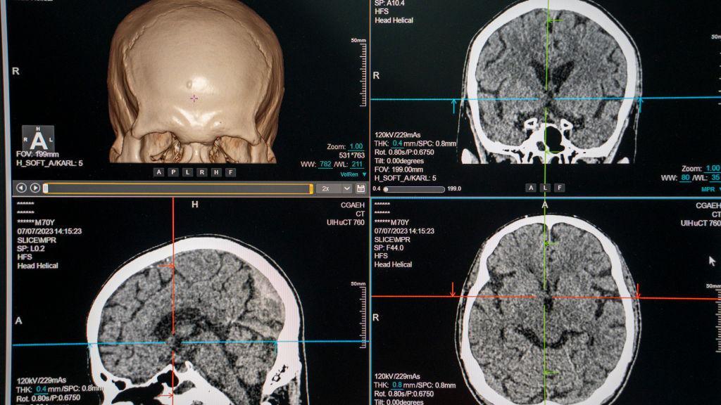 Un cerebro visto con un escáner 