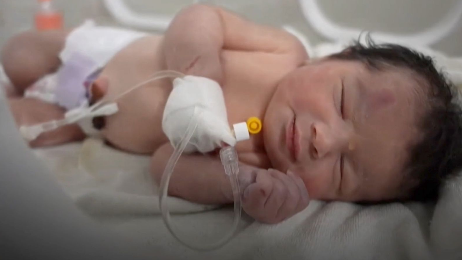 Afraa recién nacida en el hospital recibiendo tratamiento