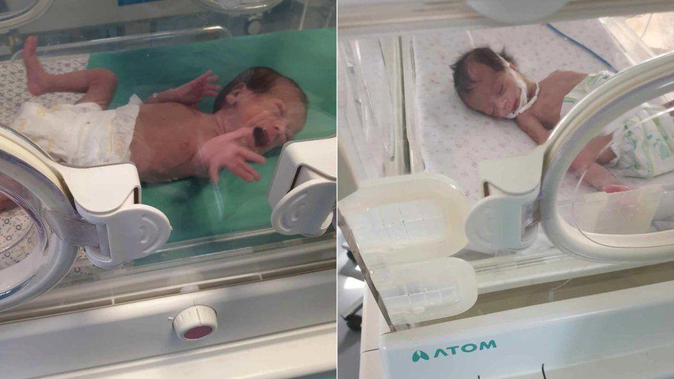 Bayi perempuan prematur Leen (kiri) dan Layan (kanan) terpisah dari ibu mereka, Nour, selama berbulan-bulan.