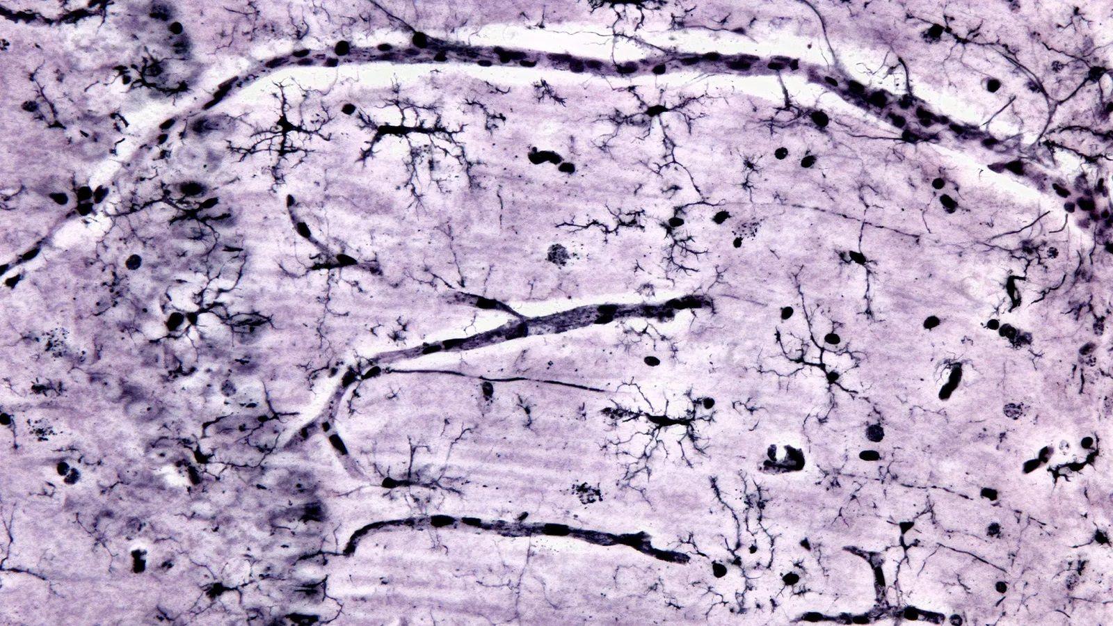 Microglia.