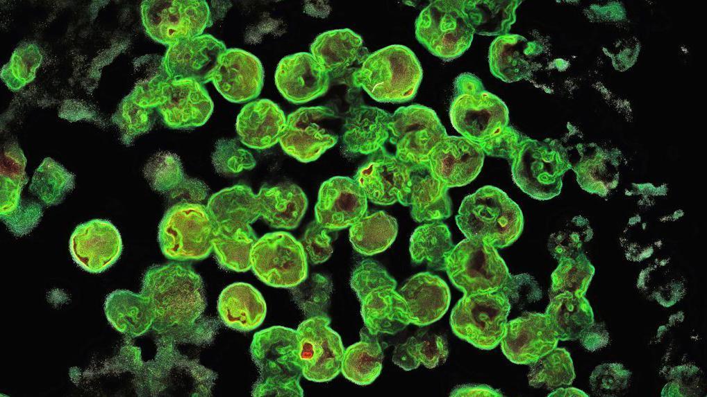 Ameba, Naegleria fowleri