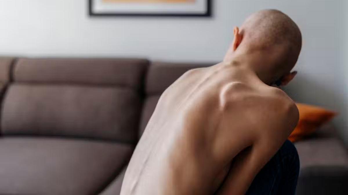 Pessoa doente com baixo peso vista de costas