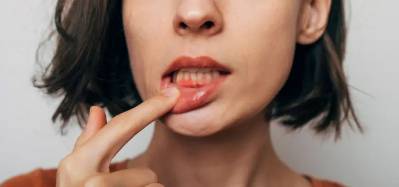 teeth