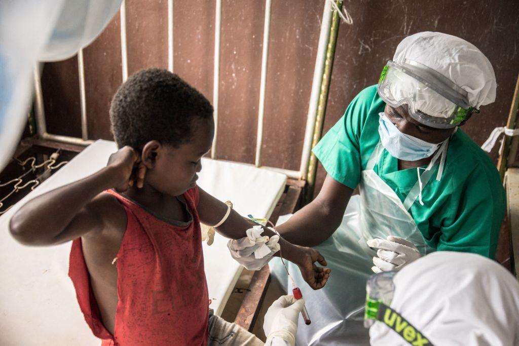 Un niño africano siendo examinado para ver si tiene mpox