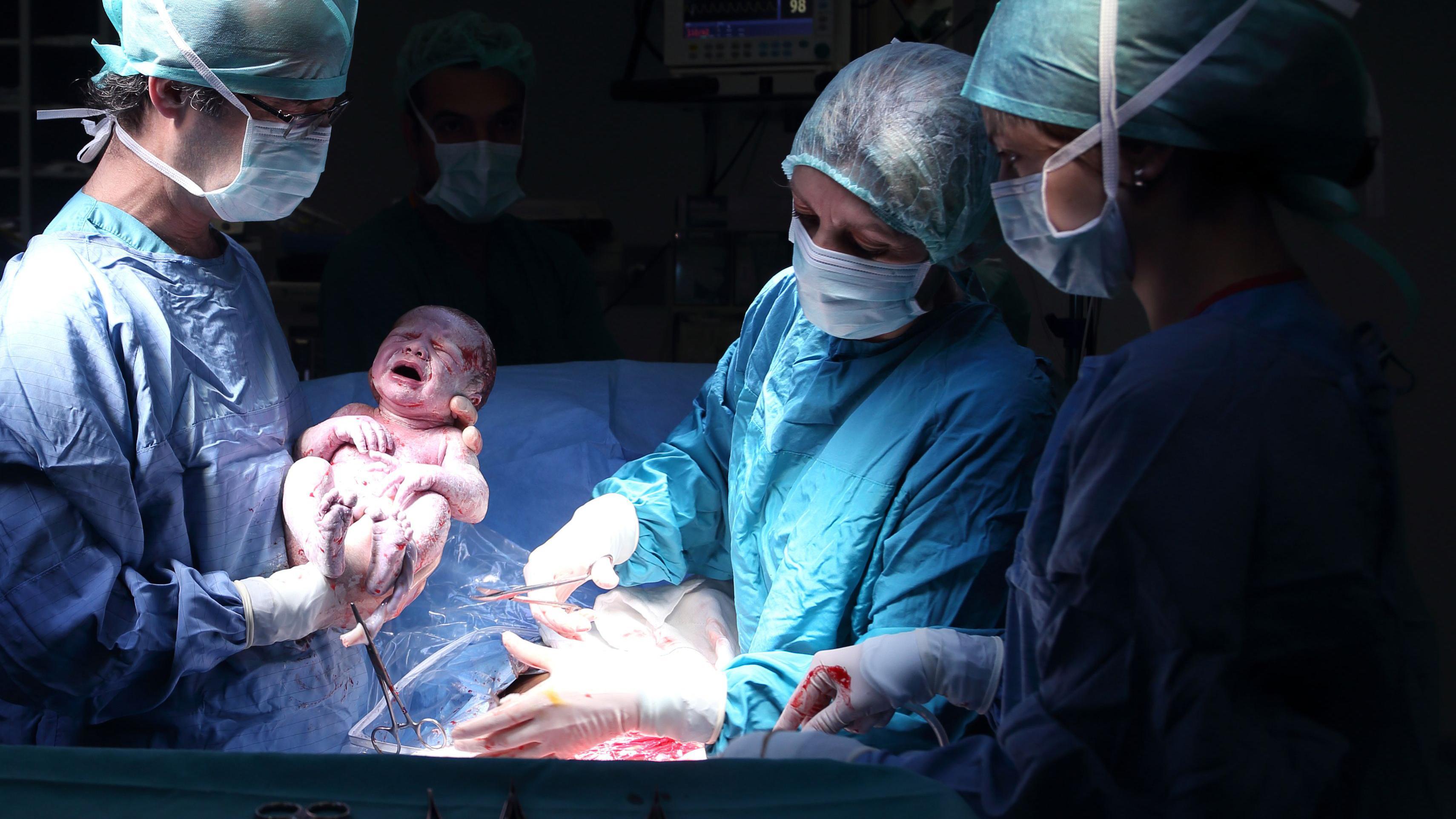 Médico segurando bebê após parto por cesariana