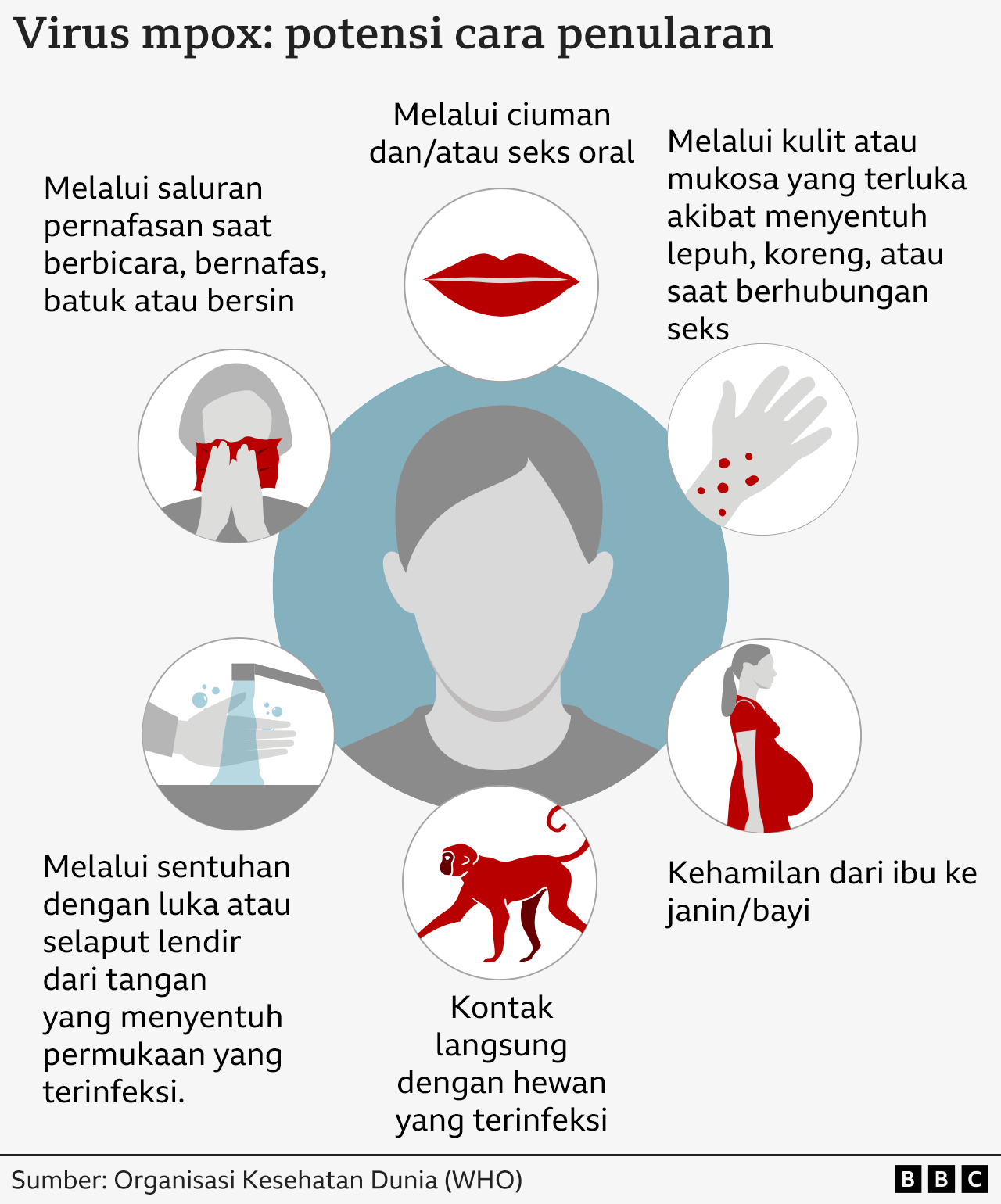 cara penularan mpox