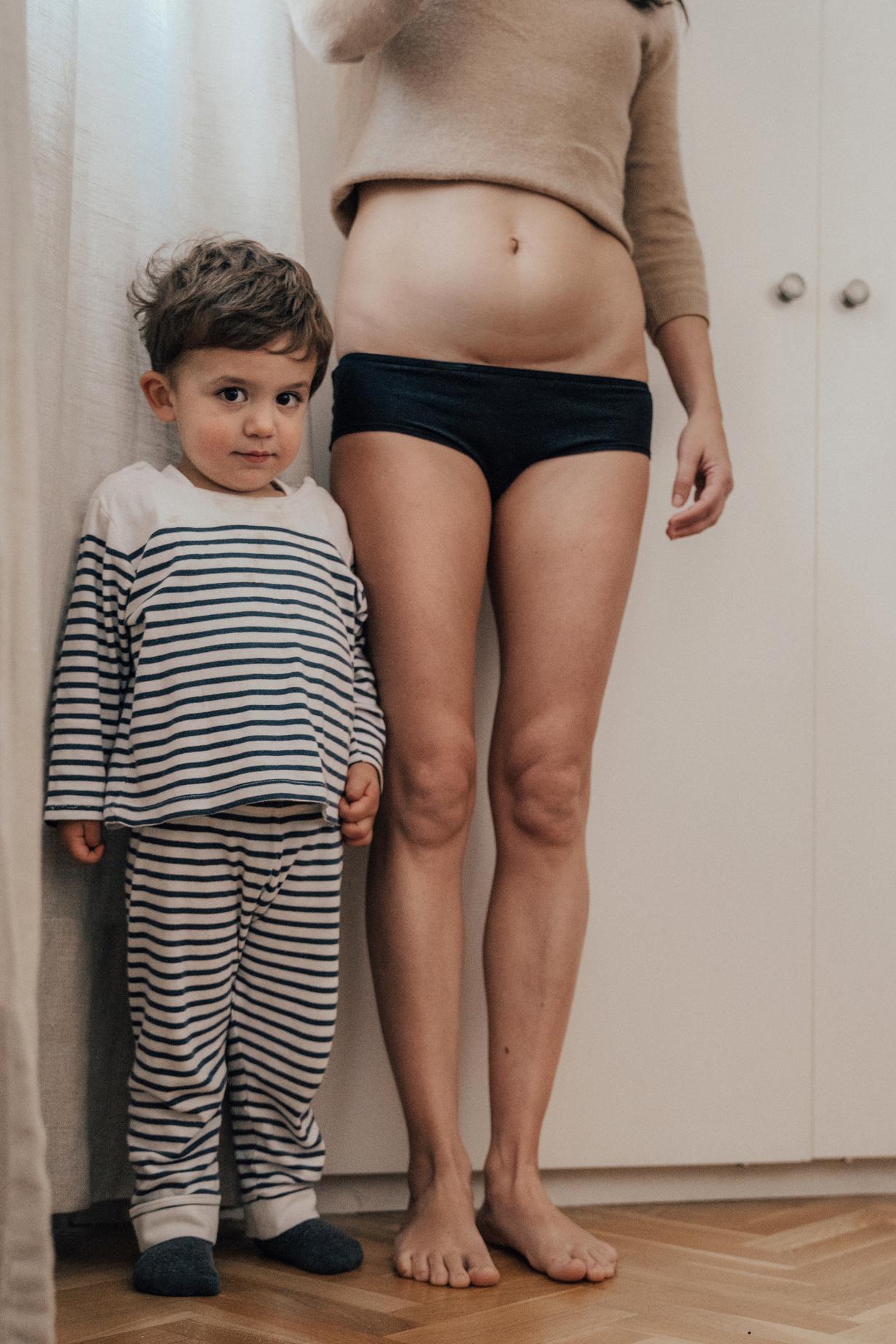 Mulher com cicatriz de cesárea de pé ao lado do filho