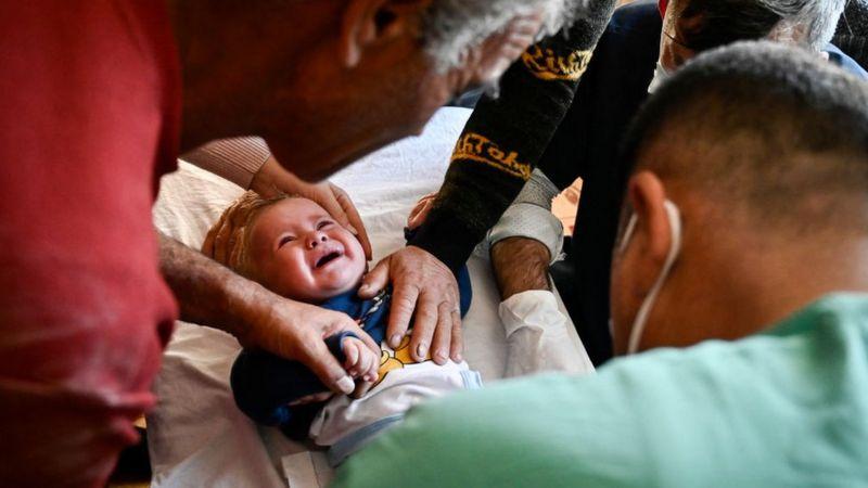Bebê chorando rodeado por homens e médicos