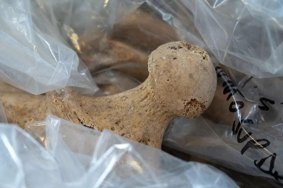 Cabeza de un fémur