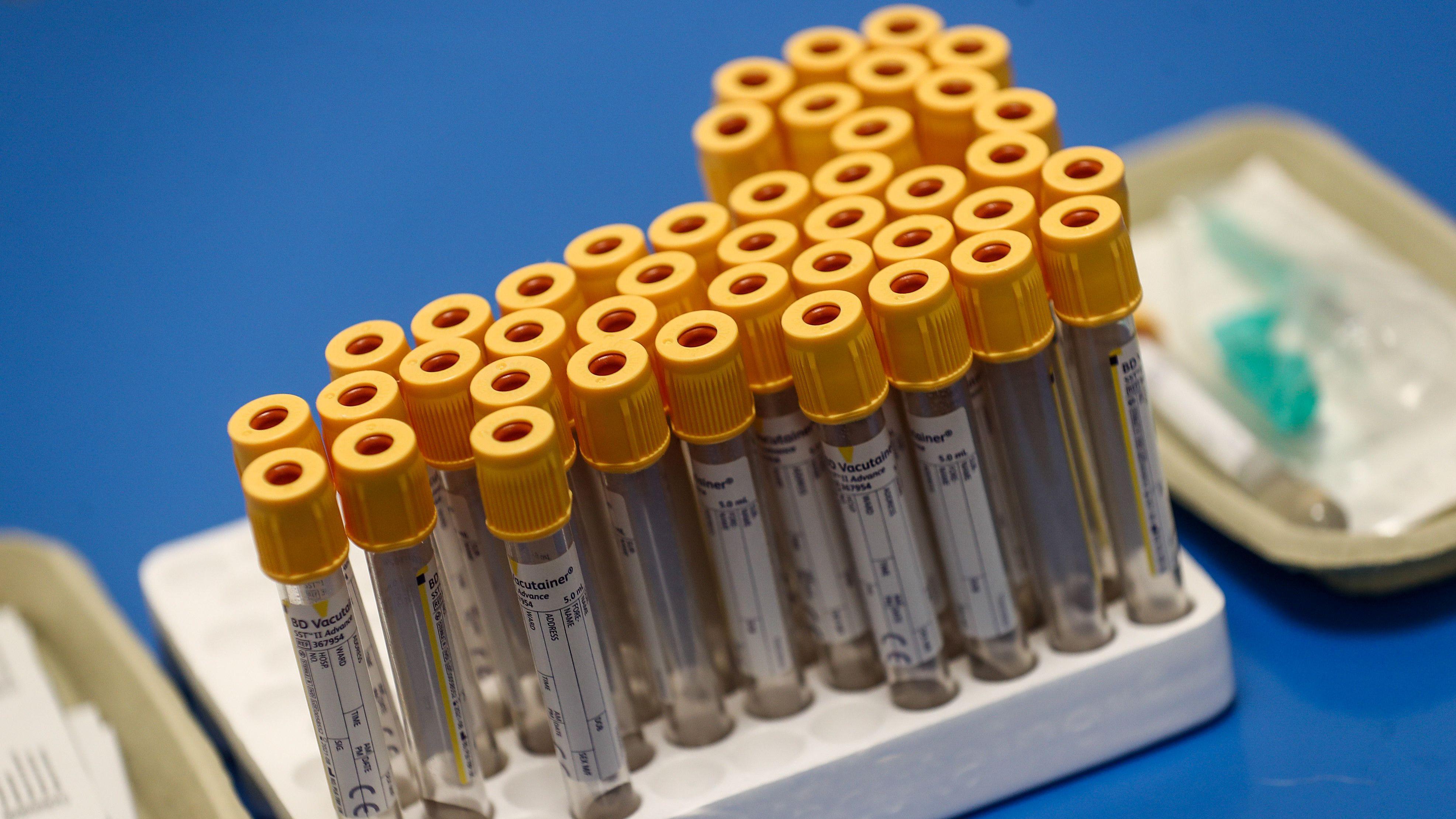 Vários tubos de plástico para a coleta de sangue com tampas amarelas, vazios e com etiquetas, enfileirados.