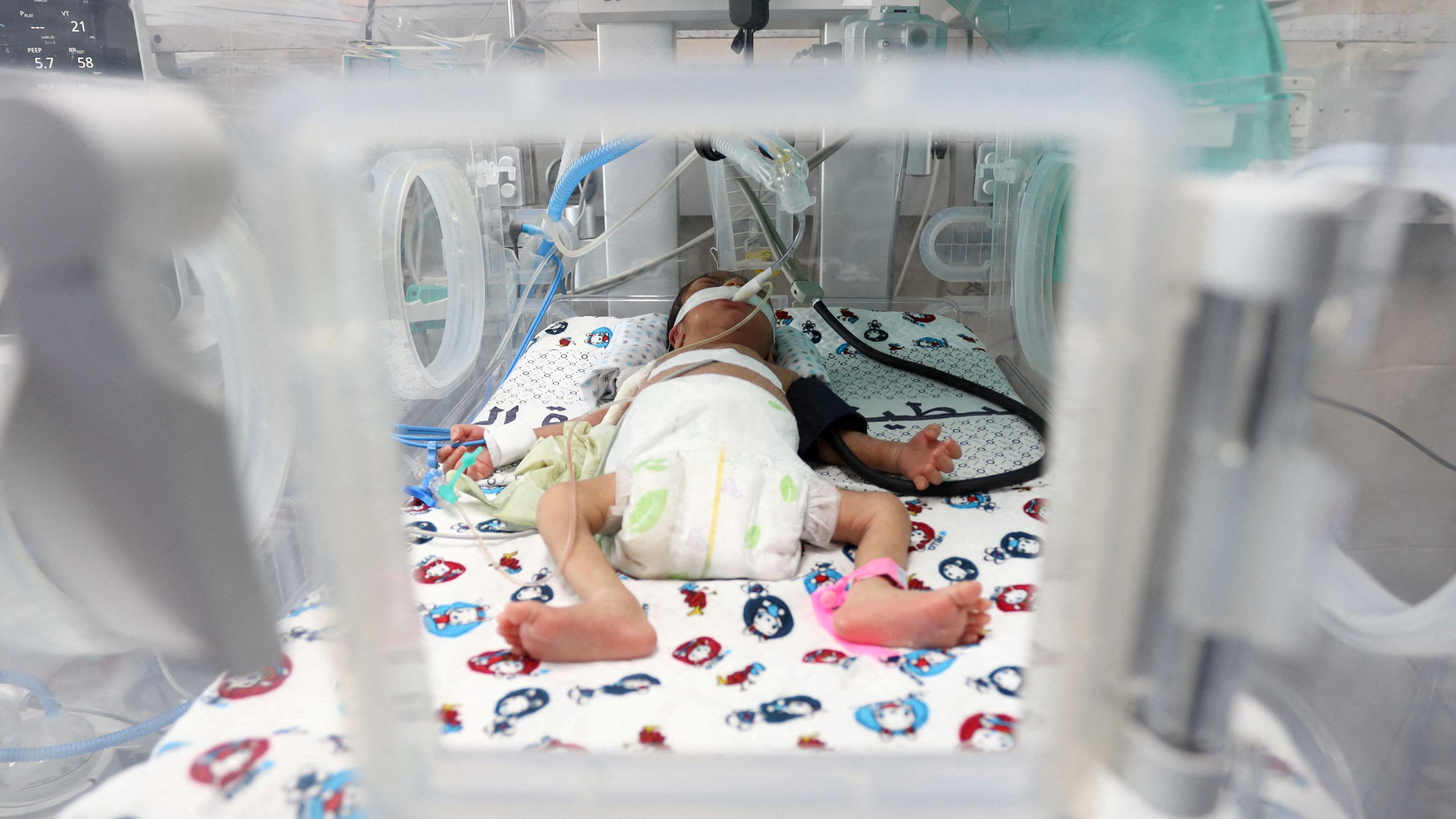 Bebé prematuro en el hospital Al Shifa en el norte de Gaza.