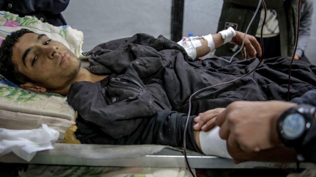 Un herido en una camilla en Gaza
