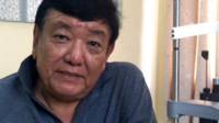 mankari doctor sanduk ruit