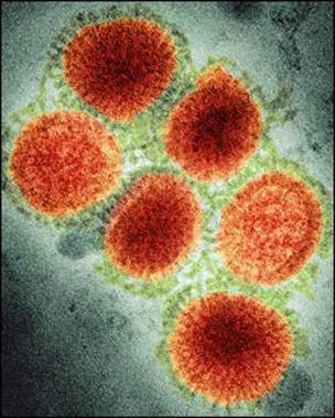 Resultado de imagen de virus de la  gripe met