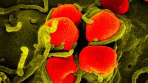 Bacteria de gonorrea