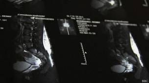 Radiografía