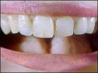 Dentes (arquivo)