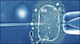 Tratamento de fertilização (arquivo)
