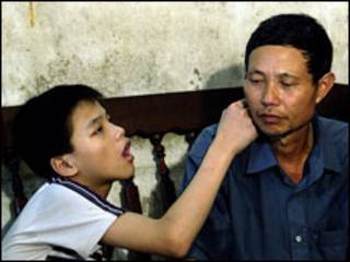 Nạn nhân chất độc da cam
