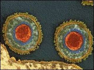 Vírus causador da herpes (arquivo)