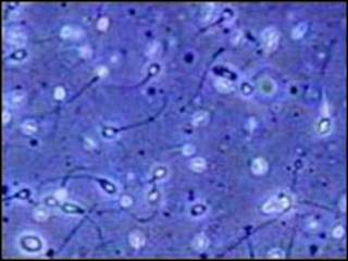 espermatozoide