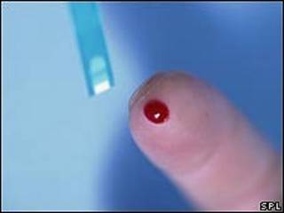 Prueba de sangre