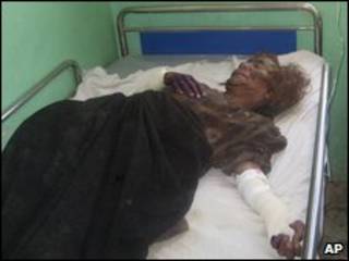 Mulher ferida em Farah, no Afeganistão