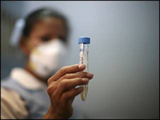 Enfermera con una muestra de gripe porcina en una probeta