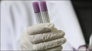 Pruebas de laboratorio de pacientes con síntomas gripales