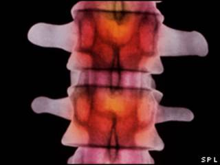 Columna vertebral vista con rayos X.