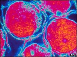 La bacteria Chlamydia trachomatis.