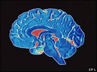 cerebro