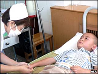 Niño chino en tratamiento