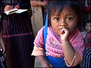 Niño desnutrido en Guatemala. Foto cortesía Unicef.