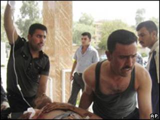Policía iraquí herido en bombardeo en Irak